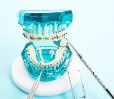 Orthodontics